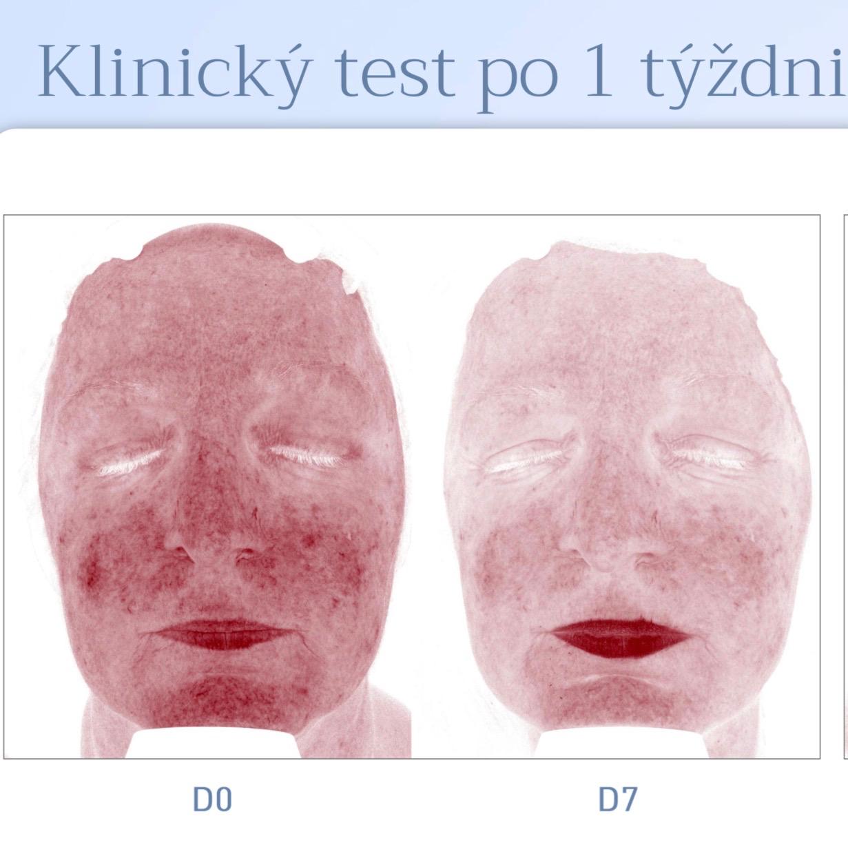 Citlivá pleť – Skeyndor Aquatherm